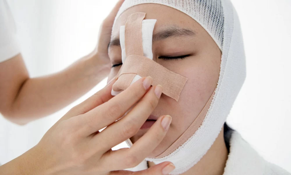 گچ بینی یا اسپلینت