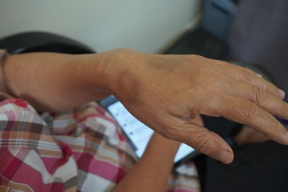 پیدا نشدن رگ دست