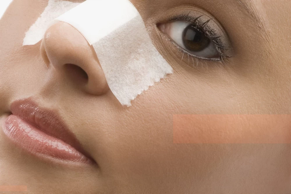 سن مناسب برای عمل بینی