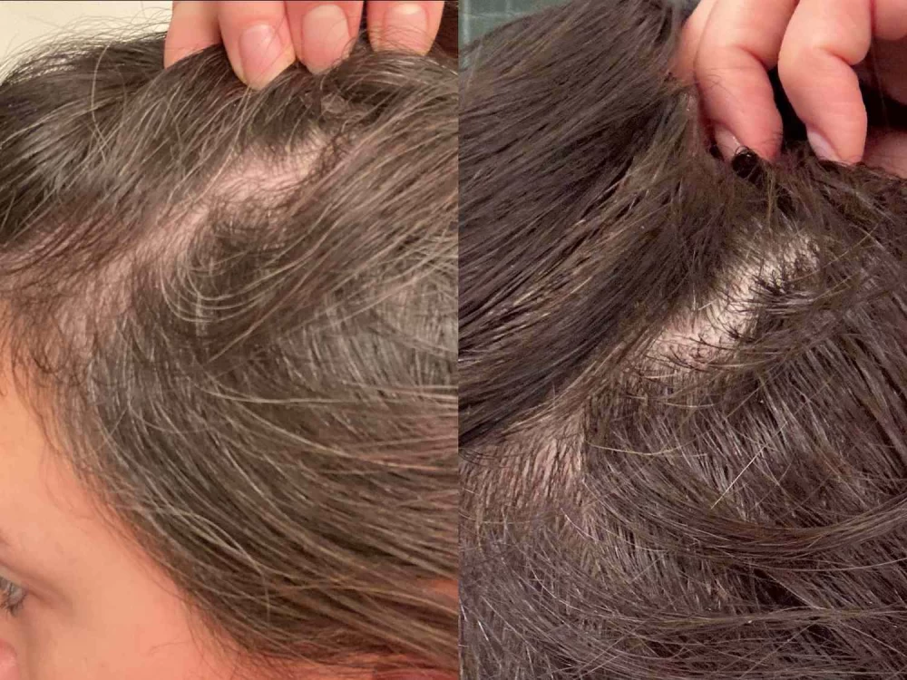 راهکارهای بهبود رشد مو