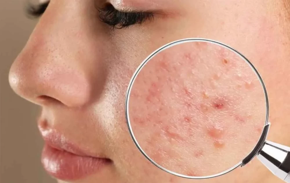  مراقبت از سلامت روده