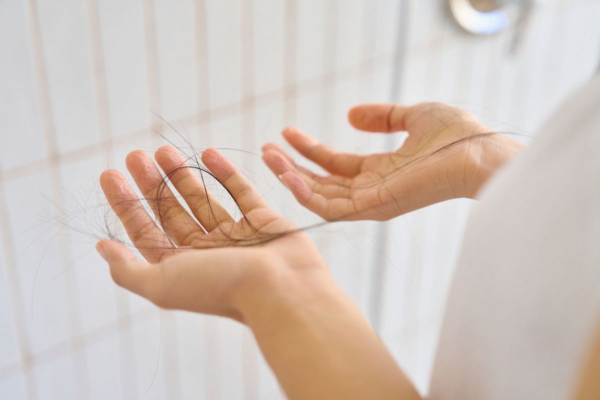 پیشگیری از ریزش مو با استموکسیدین