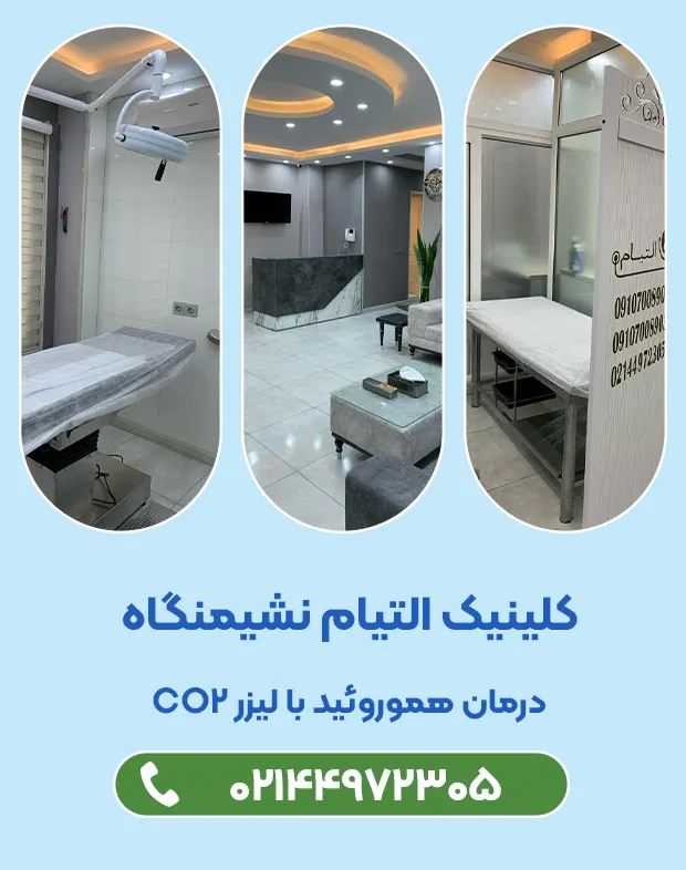 لیزر هموروئید
