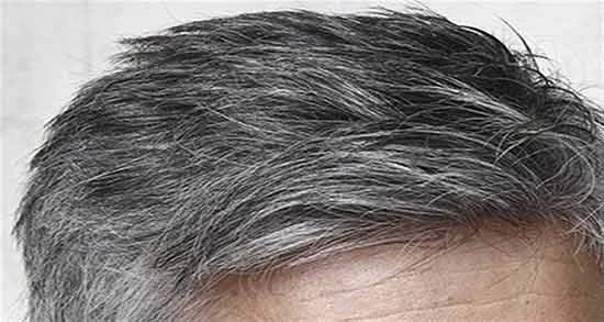 مردانساژ موی سفید چیست و چطور انجام می شود؟