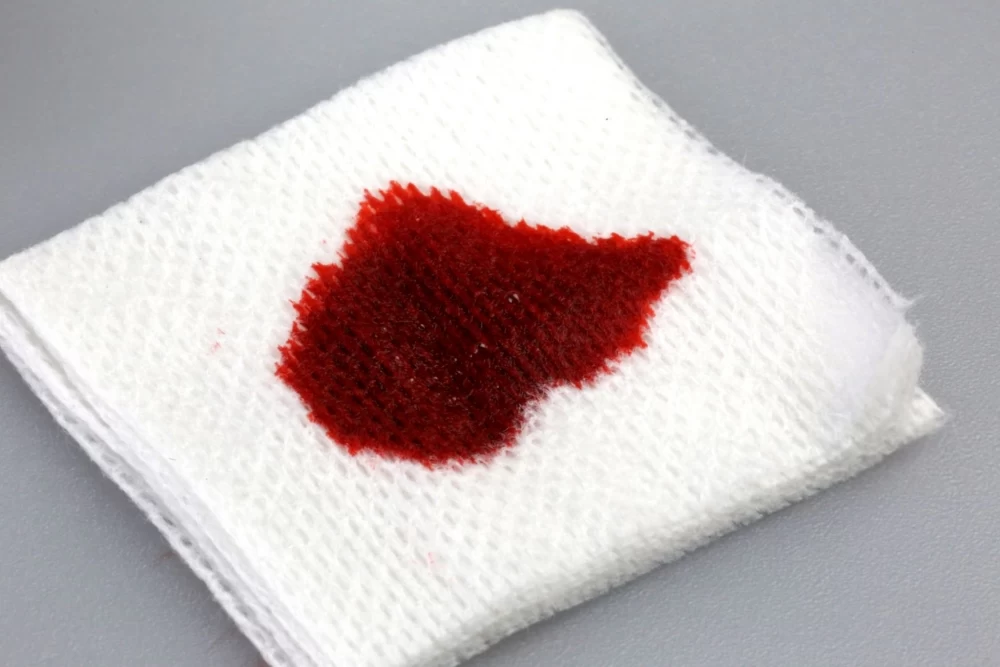 شستشو لکه خون روی حوله