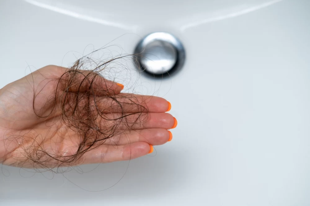 آیا چاقی باعث ریزش مو می شود؟
