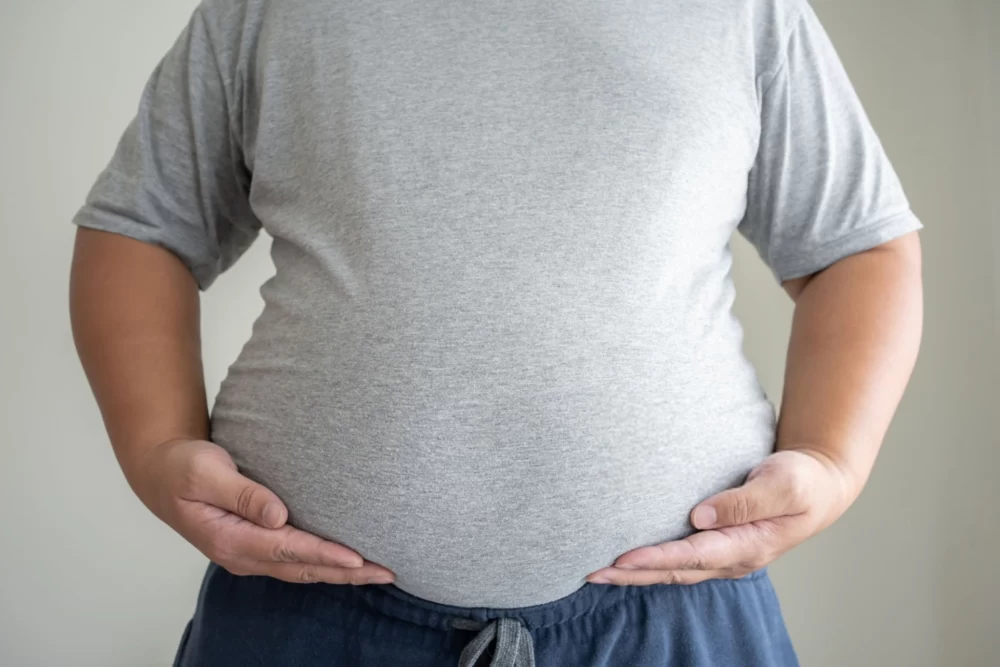 آیا چاقی باعث ریزش مو می شود؟