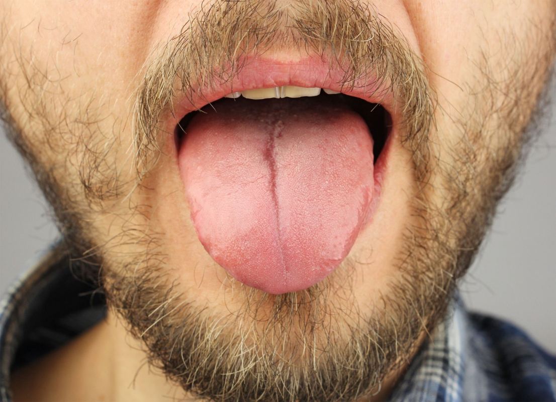 ارتباط بین رنگ زبان و سلامت بدن