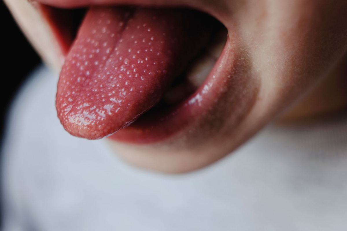 ارتباط بین رنگ زبان و سلامت بدن