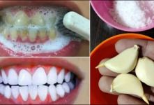 روش طبیعی و سریع رفع زردی دندان در خانه با خمیر ترکیبی دست ساز