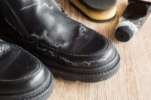آموزش از بین بردن شوره کفش در پاییز و زمستان