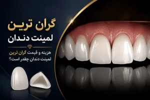 گرانترین لمینت دندان چیست و هزینه آن چقدر است؟