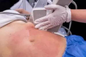 مزایا، معایب و نحوه لاغری با دستگاه ترواسکالپ