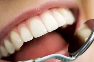 چرا دندان زرد می شود؟ ۵ ترفند طلایی برای سفید کردن دندان!