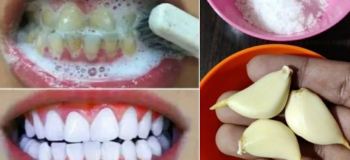روش طبیعی و سریع رفع زردی دندان در خانه با خمیر ترکیبی دست ساز
