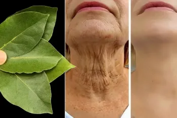 این گیاه را بوتاکس طبیعی مینامند / گیاهی که به کلاژن سازی طبیعی کمک میکند
