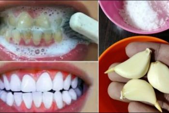 روش طبیعی و سریع رفع زردی دندان در خانه با خمیر ترکیبی دست ساز