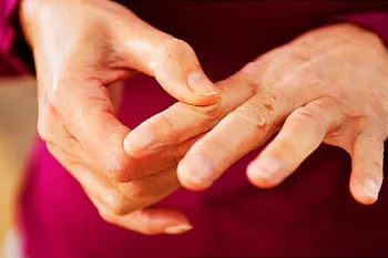 علائم آرتریت روماتوئید در اندام های مختلف: از مفاصل دست تا قلب و چشم