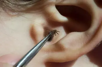 روش های ایمن خارج کردن حشره از گوش