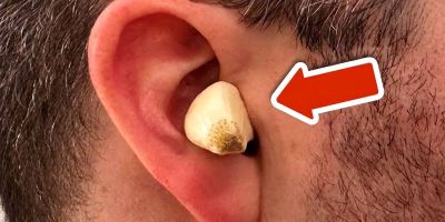 روش سنتی قرار دادن