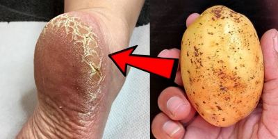 از بین بردن خشکی و